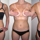Image for article titled The Strappy Swimsuit Trend Creates the World's Worst Tan Lines